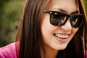 How Much Do Braces Cost for Kids