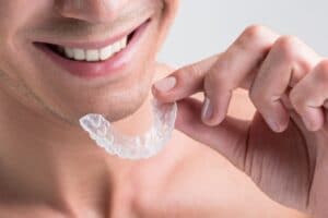 Invisalign In Modesto