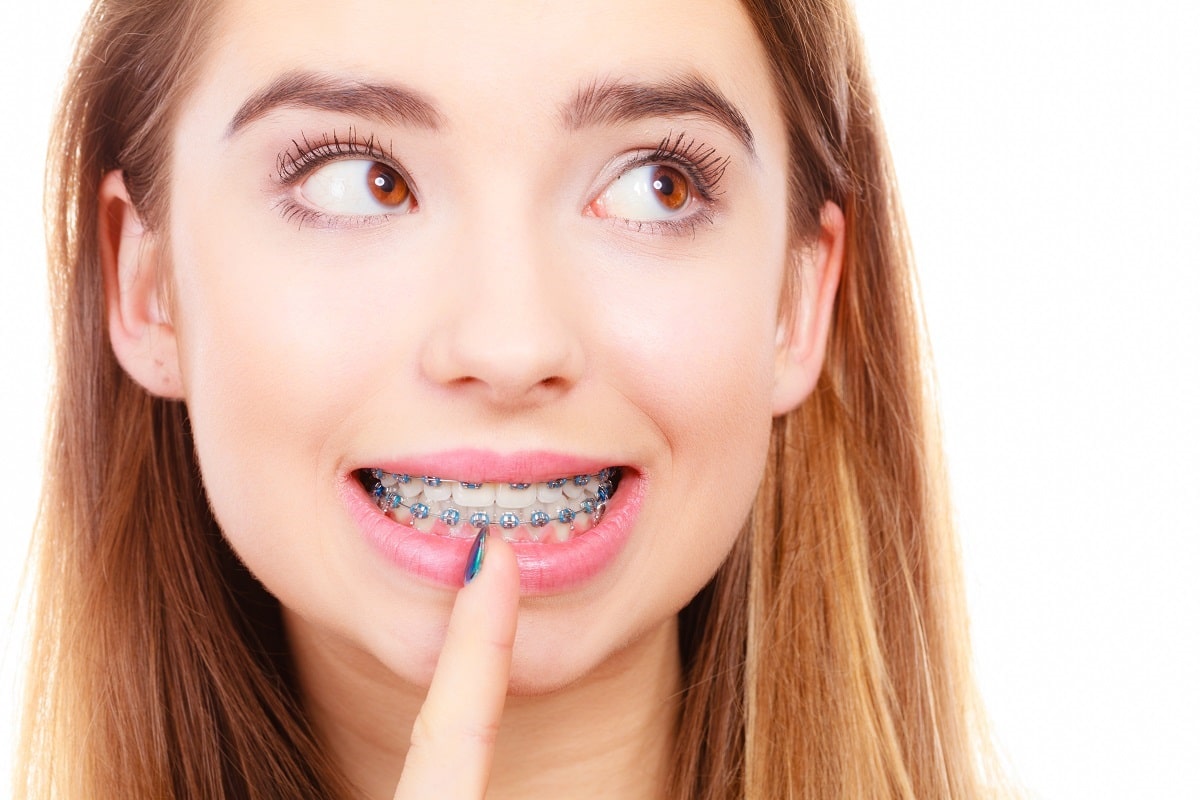 How Much Do Braces Cost in Modesto? - Pezoldt Orthodontics
