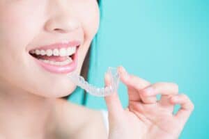 Clear Aligners Oakdale