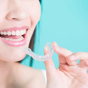 What Is The Youngest Age For Invisalign