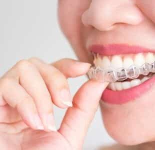Pros And Cons Of Invisalign As The New Braces In Modesto