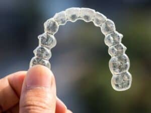 Pros And Cons Of Invisalign 